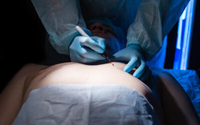 Male Breast Reduction Surgery: Why It’s More Common Than You Think